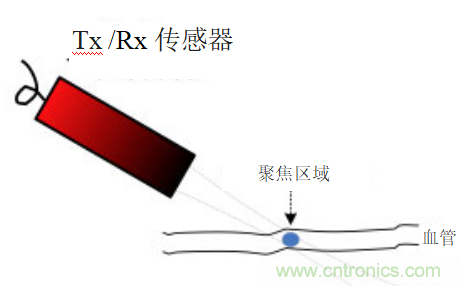 超聲系統(tǒng)的信號(hào)鏈設(shè)計(jì)注意事項(xiàng)